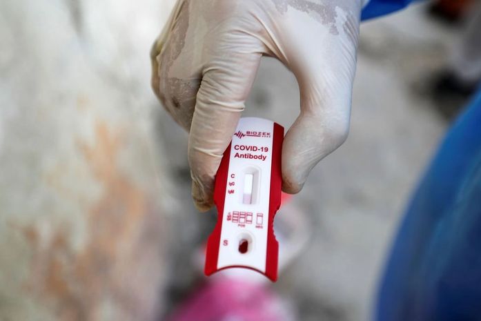 Covid-19: pessoas com sintomas devem procurar atendimento imediato