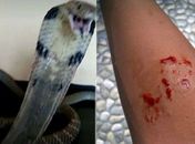 Criança morre após ser picada por cobra de estimação e pedir ajuda na internet