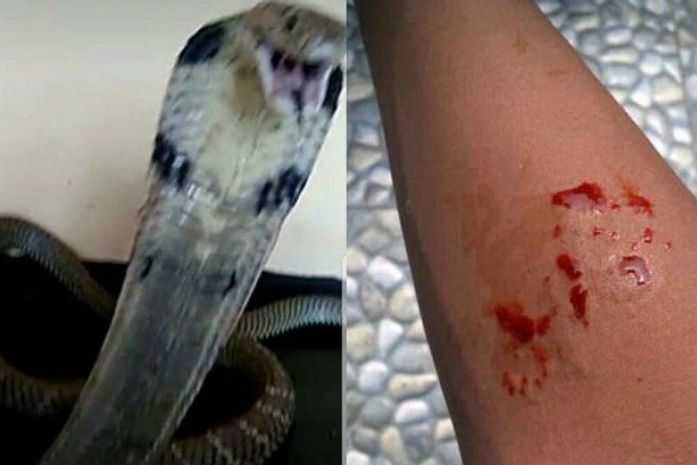 Criança morre após ser picada por cobra de estimação e pedir ajuda na internet