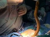 Relembre as 10 vezes que o ser humano surpreendeu os médicos em 2017