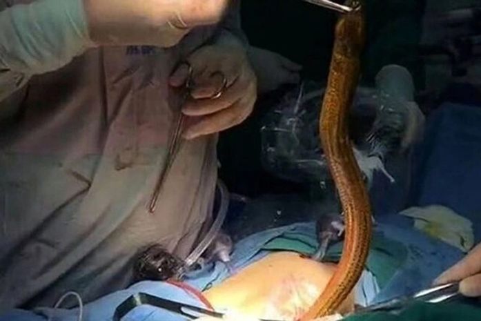 Relembre as 10 vezes que o ser humano surpreendeu os médicos em 2017