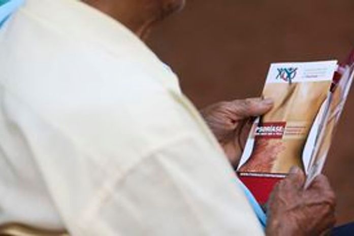 SUS oferece mais quatro medicamentos para tratar psoríase