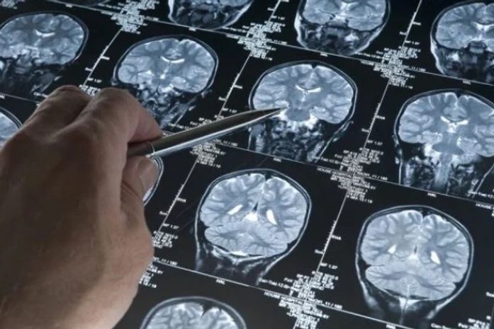 Frutose não só ajudaria a desativar as áreas do cérebro responsáveis por essas funções diminuindo o fluxo sanguíneo