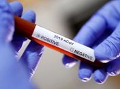 Bahia registra primeiro caso do novo coronavírus