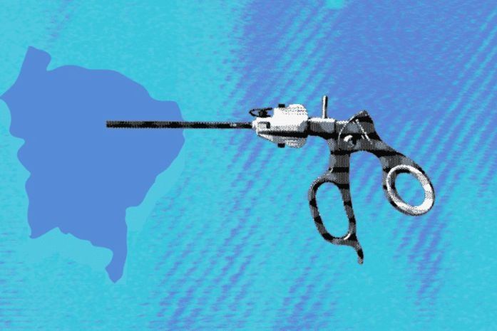 Hospitais públicos estaduais e municipais não contam com laparoscópio; estado possui o menor número do Nordeste