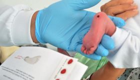 Dia do Teste do Pezinho: Pediatra da Sesau ressalta a importância do exame para diagnosticar doenças precocemente