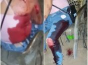 Major Izidoro: Mulher é atingida por outra com vários golpes de faca, autora confessa o crime e vai presa