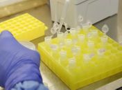 AL entra em nível de alerta para Síndrome Respiratória Aguda Grave impulsionada por casos infantis