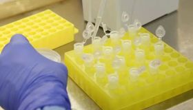 AL entra em nível de alerta para Síndrome Respiratória Aguda Grave impulsionada por casos infantis